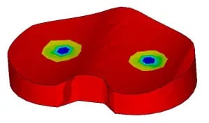 Contact Stress Analysis of an Artificial Knee1