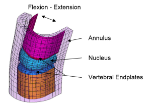 FEA-Model-of-Spinal-Implant-Test-Fixture-300x210