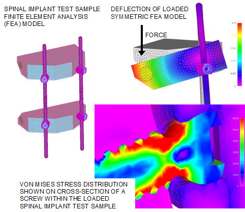 Fatigue Analysis of a Spinal Implant